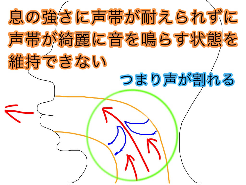 喉締め発声の原因と対策について