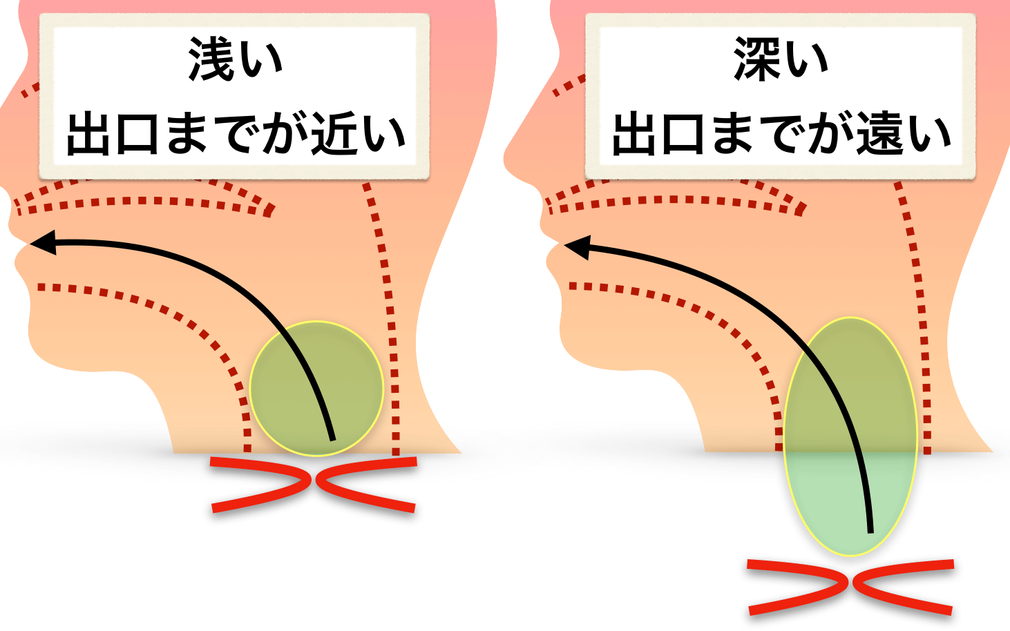喉頭位置と音の出口