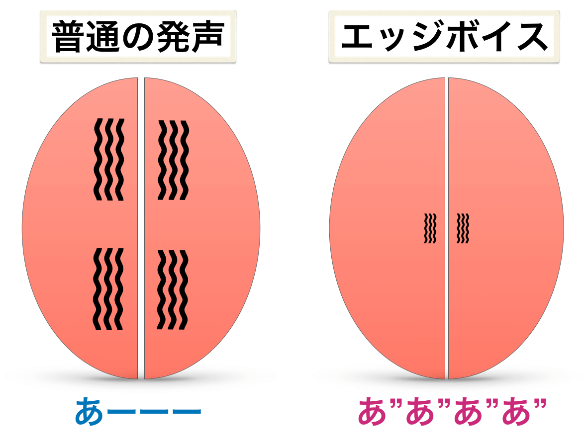 エッジ ボイス やりすぎ